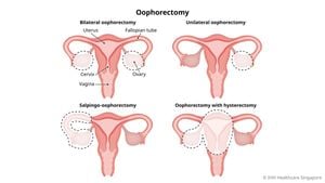 New Surgical Protocol For Hysterectomy And Ovariectomy In Mice