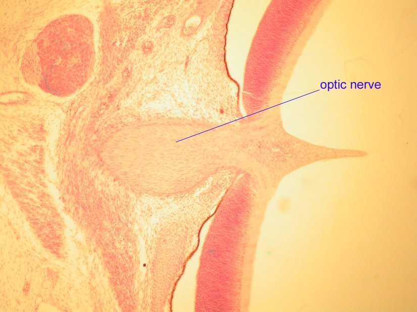İnsanların gözünde kör nokta oluşmasına neden olan sinir yumağının dokusal düzeyde çekilmiş bir fotoğrafı... Bu nokta nedeniyle bu canlılar görüş alanı dahilindeki bazı bölgeleri göremezler. Göz, bir insan mühendisi tarafından bile, şu anda olduğundan kat kat iyi tasarlanabilirdi.