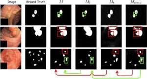 New Network Enhances Polyp Segmentation Accuracy Using Frequency Attention