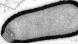 SİBİRYA'DA DONMUŞ HALDE Kİ VİRÜSLER