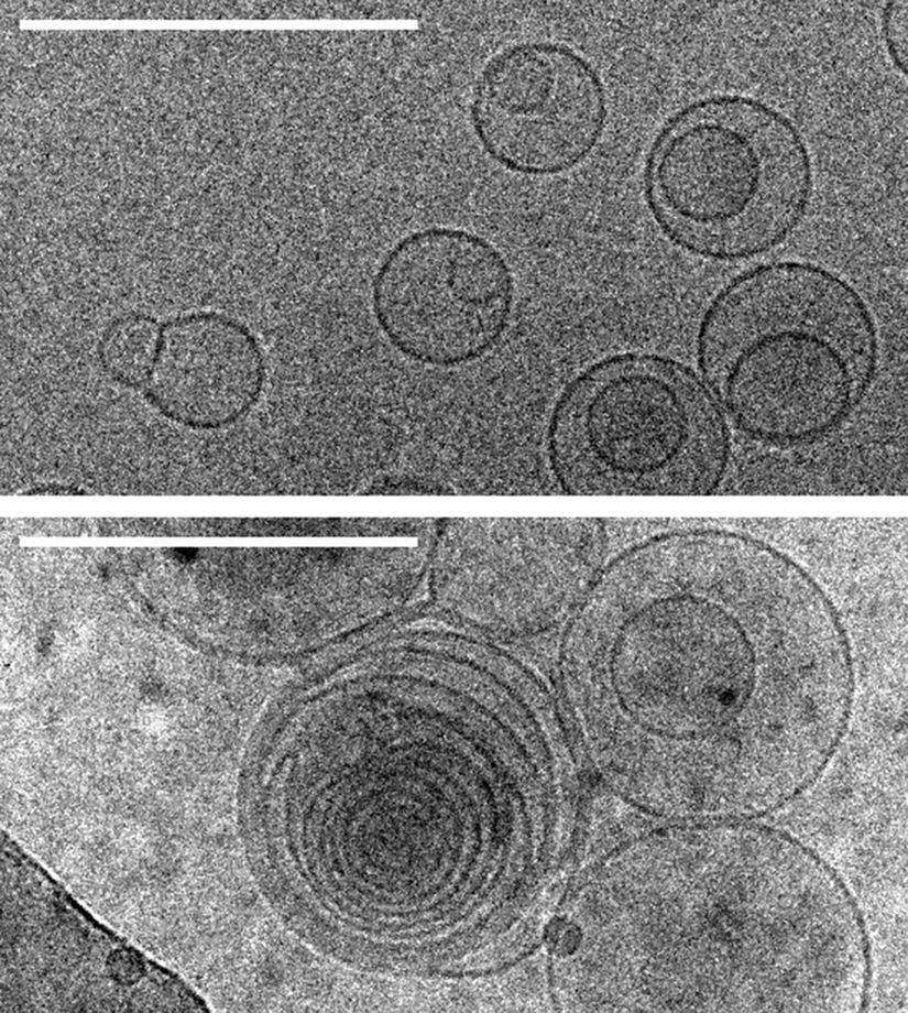 Transmisyon elektron kriyomikroskopisi kullanılarak alınan, daire şeklinde görünen zarların fotoğrafı. Üstteki görsel: aminoasit içermeyen hücre zarları, magnezyum klorür solüsyonu, zarların yapısını bozan tuzlar. Alttaki görsel: magnezyum klorür ve serin solüsyonundaki zarlar ve zarları birden çok eşmerkezli zar oluşturmak üzere tetikleyen bir aminoasit. Ölçek çubukları: 100 nanometre.