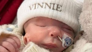 Baby Vinnie Born With Rare Condition Inspires Community