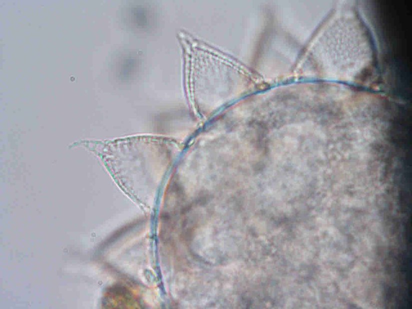 Eutardigrada sınıfından Macrobiotidae familyasından bir tardigrada ait olduğunu düşündüğümüz yumurta yapısı.