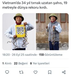 Neden tırnaklarımız uzamaya devam ediyor?