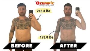 Ozempic Drives Obesity Decline But Raises Health Concerns