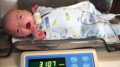 Burunsuz Doğan Bebek: Eli Thompson