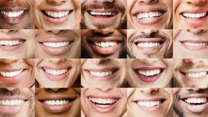 Italians Embrace Aesthetic Dentistry Revolution