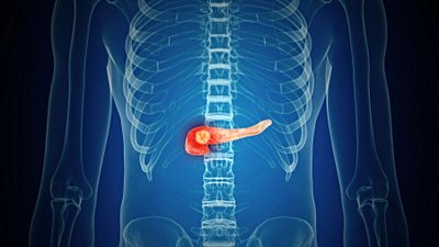 Yapay Pankreas, Şeker Hastalığı İçin Yeni Bir Umut Olabilir!