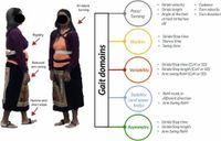 Digital gait biomarkers in Parkinson’s disease: susceptibility/risk, progression, response to exercise, and prognosis - npj Parkinson's Disease