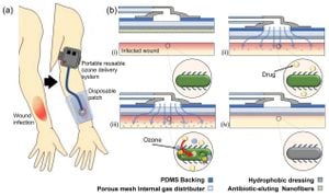 New Ozone Dressing Shows Promise For Healing Bullous Pemphigoid Wounds