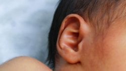 Dil Edinimini Sınırlayan Bir Faktör Olarak İşitsel Gelişim