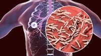 World Tuberculosis Day 2025: What Is TB Disease? Know Causes, Symptoms, Diagnosis And Treatment