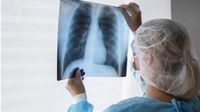 Qué es la silicosis: la enfermedad que ha resurgido en España con 520 casos en 2024