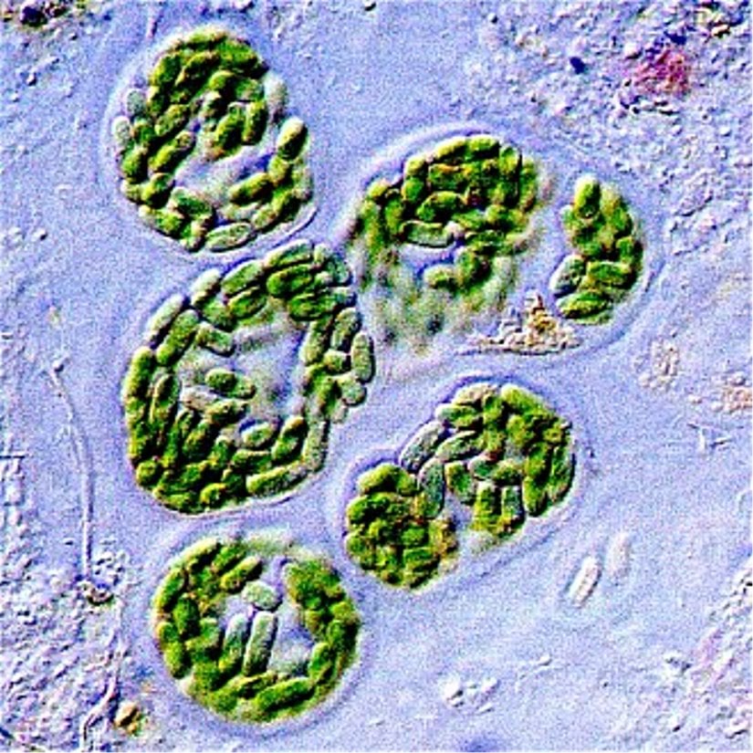 Deniz suyunda siyanobakteri hücreleri (mikroskobik görüntü)