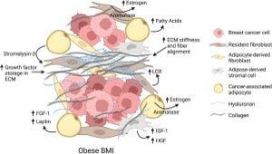 BMI's Influence On Breast Cancer Treatment Outcomes Challenged