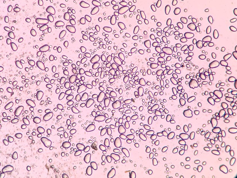 Şekil 1. Patates Nişastası, 100x