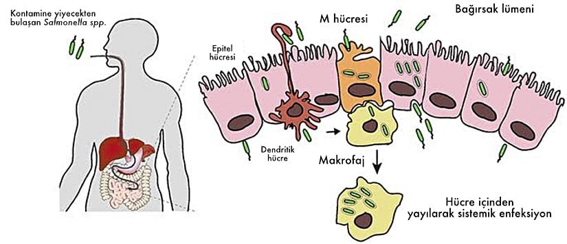 Sistemik enfeksiyonun şematik görüntüsü.