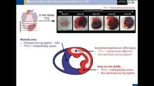 Targeting Spleen IRF7 Could Transform Heart Injury Treatment