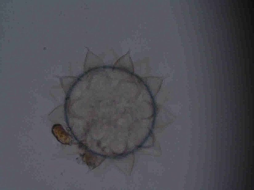 Serbest ortama bırakılan Macrobiotidae familyasına ait bir yumurta.