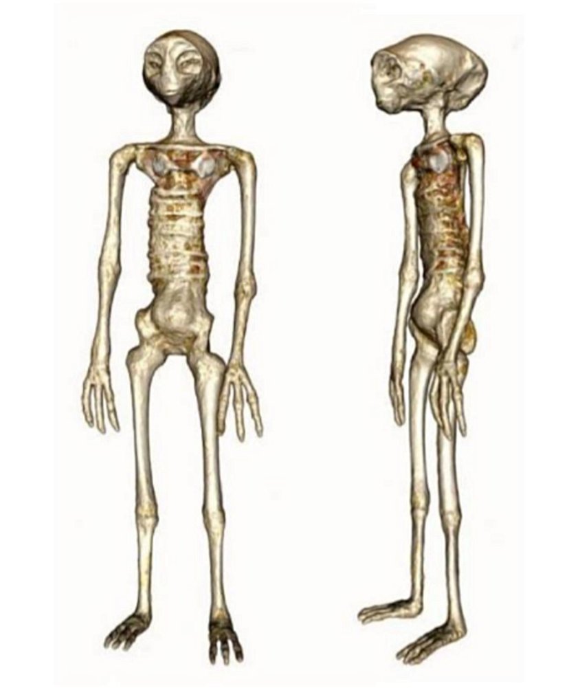 Şekil 1. Göğsünde metal bir plaka ve karnında dört oval nesne  bulunan “Josephina”nın önden ve yandan görünümü