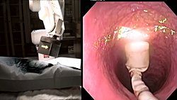 Manyetik Endoskopi, Bağırsak Kanserinin Teşhisinde Kilit Rol Oynayan Kolonoskopi Teknolojisinde Büyük Bir Atılım Sağlayabilir!