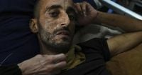 Photos of displaced people in Gaza battling stifling heat amid food and water shortages