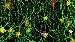 Kaybedilen Anıların ve Unutulan Hafızanın Bazı İzleri Hücre Çekirdeğinde Saklanıyor Olabilir!