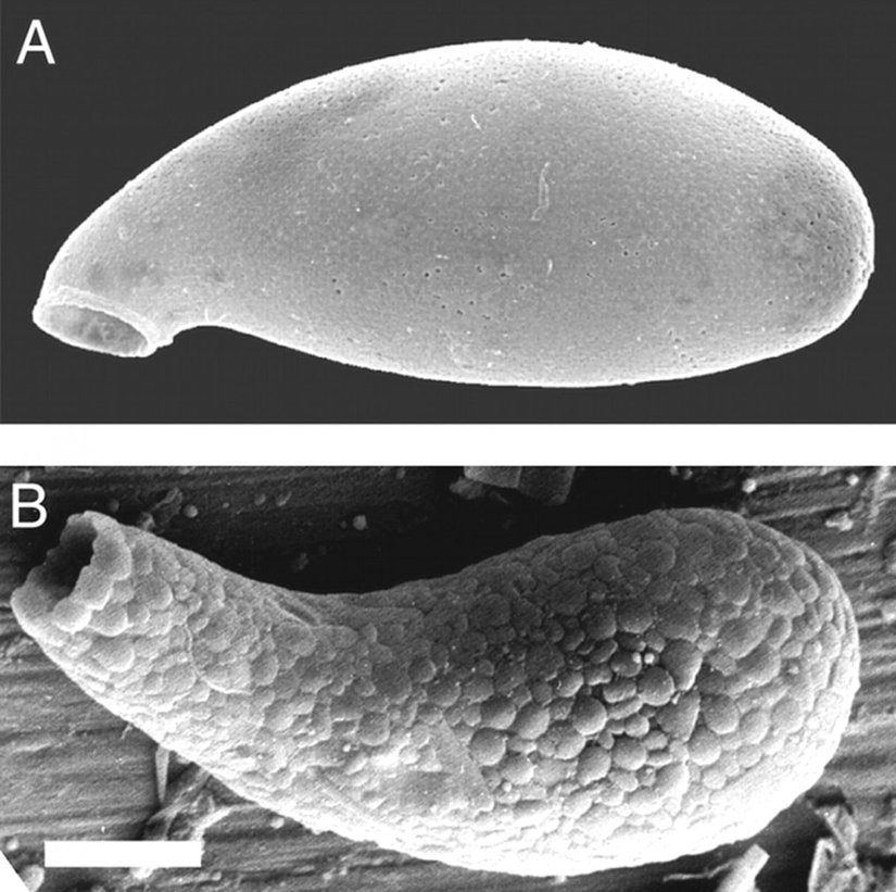 Mikroskobik düzeyde de olsa 1200 milyon yıl öncesinden itibaren canlılar giderek karmaşıklaşmaya başlamıştı. Fotoğrafta, 750 milyon yıl önce yaşamış bir testat amip gözüküyor. Bu amipler, gruplarının en karmaşık yapılı canlılarından birisidir.