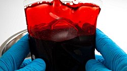 Bombay Kan Grubu (hh Kan Grubu) Nedir? Bu Nadir Kan Grubunu Bilmek Neden Önemlidir?