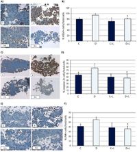 Study of the efficacy and the mechanism of action of lanreotide for the treatment of persistent diabetic macular edema - Scientific Reports