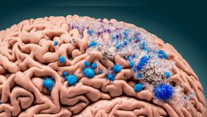 Surge Of Microplastics Found In Human Brains Raises Health Concerns