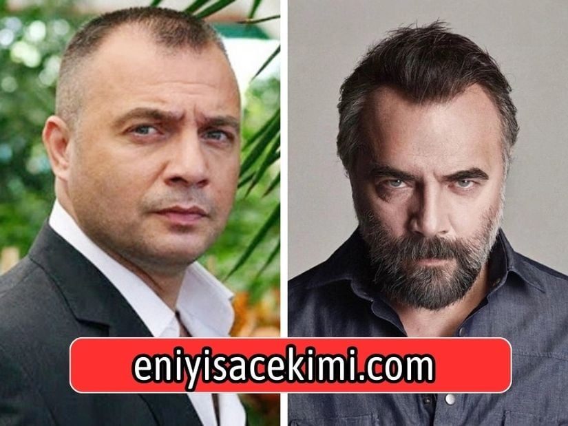 Oktay Kaynarca Saç Ekimi Öncesi Ve Sonrası