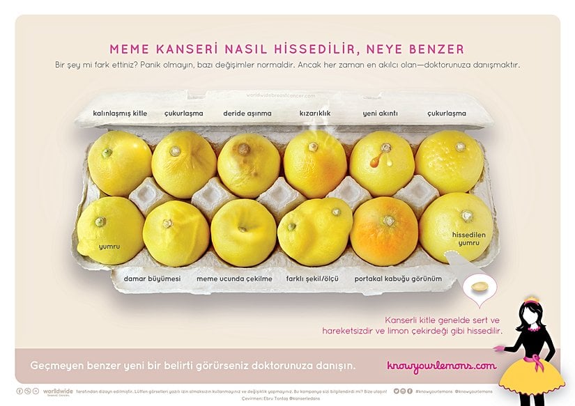 Meme kanseri farklı şekillerde kendini gösterebilir. Memede bu görseldekine benzer değişiklikleri görürseniz, mutlaka doktorunuza danışınız.