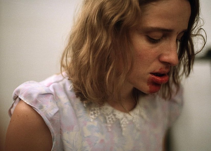 Küçük kızın köpek dişini sökme girişimi.