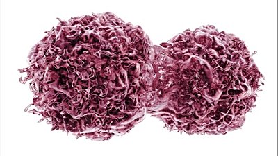 Kanser Biyolojisi: Tümör Tetikleyiciler ve Tümör Baskılayıcılar