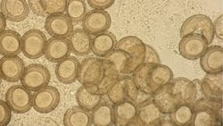 Koprolojide Sayısal Ve Tanısal Yaklaşımlar