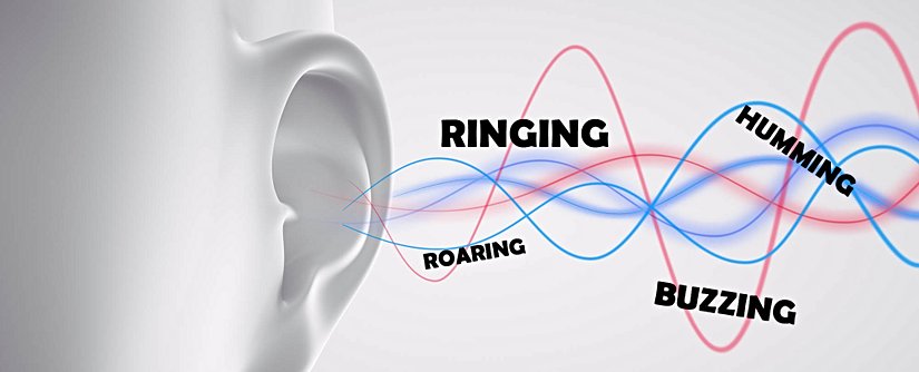 Tinnitus (Kulak Çınlaması)