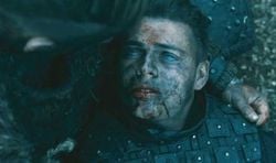 Vikings dizisindeki ivar the boneless karakterinin gözlerindeki mavileşme gerçekte mümkün olabilecek bir şey mi?