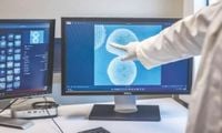 Scientists use human mini-brains to power computers
