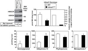 Researchers Uncover How Ubiad1 Affects Hepatic Lipid Metabolism