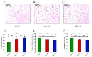 New Tool PixCell Revolutionizes Analysis Of Adipocyte Lipid Sizes