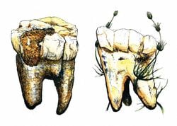 Australopithecus’un Diyeti: Et Değil, Bitkiler ve Meyveler Hakimdi.