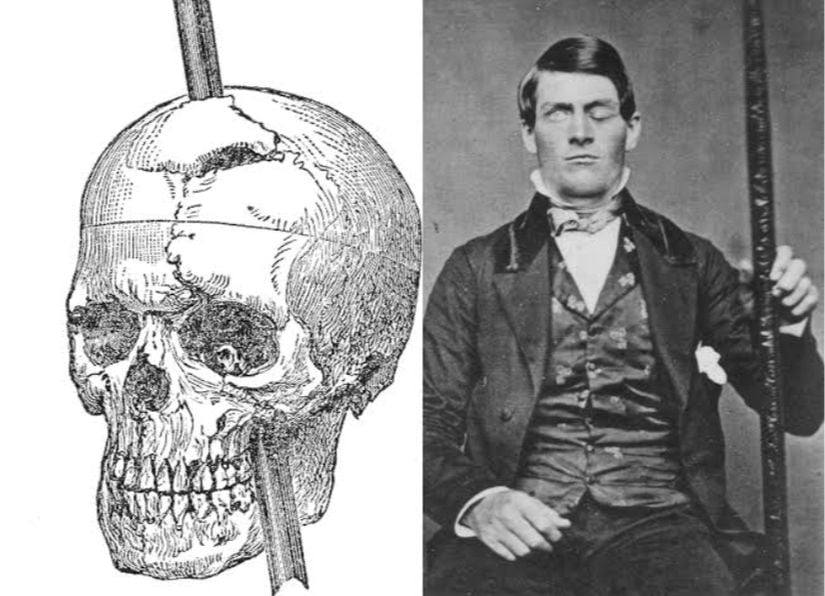 Phineas P. Gage