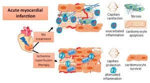 Serpina3k Lactylation Offers New Heart Injury Protection