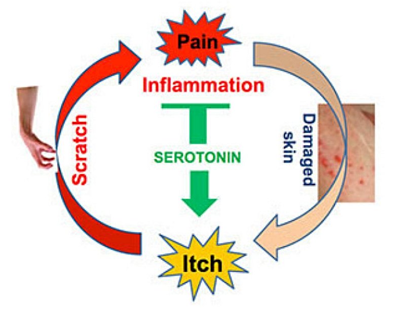 Serotonin tarafından sürdürülen acı-kaşınma döngüsü