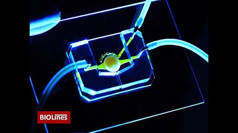 Bir göz çipi; mikroakışkan kanallar (sarı) besinleri merkezdeki yuvarlak platformda bulunan hücrelere getirir. Ekip, ek olarak göz kapağını kırpmayı simüle eden mikro göz kapağını bu çipe eklemiştir. - Dan Huh Laboratuvari, Pennsylvania Üniversitesi