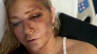 Virginia Giuffre: What is the truth after crash left her with 'days to live'? | ITV News