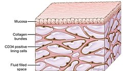 İnterstisyum: Yeni Organ Keşfedildi Mi?