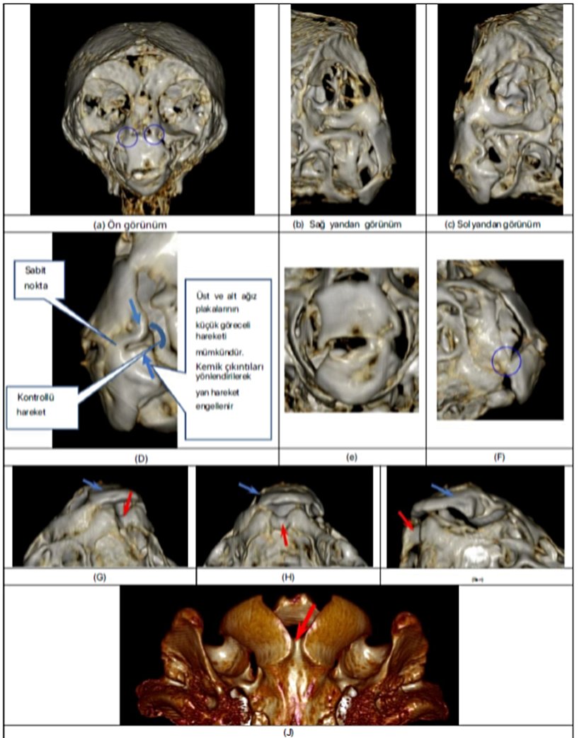 Şekil 6. (a) Kafatasının sert kemiğinin ön ve (bc) yan görünümleri, üst ağız plakasının ayrı bir plaka değil, yüz iskeletinin bir  parçası olduğunu göstermektedir. (d) Ağız plakalarının izin verilen göreceli hareketinin yakından incelenmesi. (e) Alt ağız  plakası, ağız açıklığında üst ağız plakasına bağlanır. (f) Alt plakanın sağ alt tarafının bukkal plakalardan birine bağlantısı daire  içinde gösterilmektedir. (g) Alt ağız plakasının sağ tarafını mavi okla gösteren lateral-ventral görünüm. (h) Ventral görünüm. (i)  Sol tarafı gösteren lateral-ventral görünüm.  Ayrıca kırmızı okla gösterilen silindirik kanalı da gözlemleyin. (j) Lama oksipital kemiğinde (tüberkülum farengeumunun sonu)  gözlenen silindirik kanal (kırmızı ok), Josephina'nın kafatasındaki özelliğe benzemektedir.