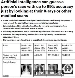 Irkın biyolojik temeli var mı?
